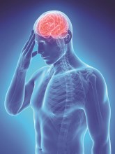 La peligrosa relación entre la fibrilación auricular y el ACV