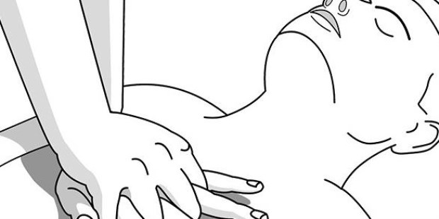 Reanimación cardiopulmonar