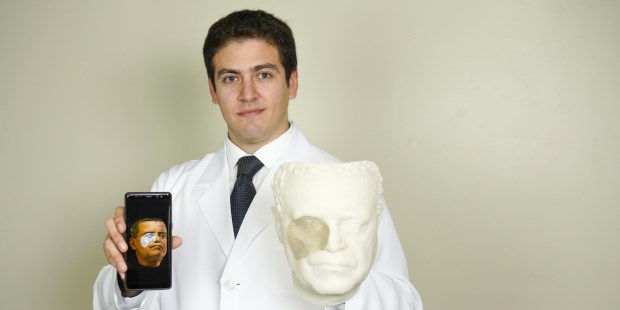 Prótesis impresas en 3D devuelven la identidad a las personas
