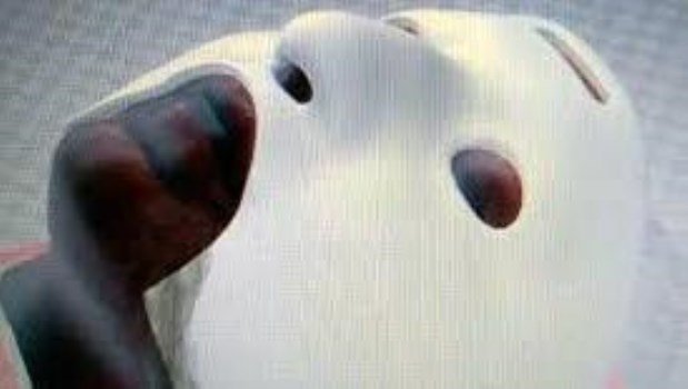 Cirujanos argentinos crearon una máscara 3D para reconstrucción facial en casos de quemaduras profundas