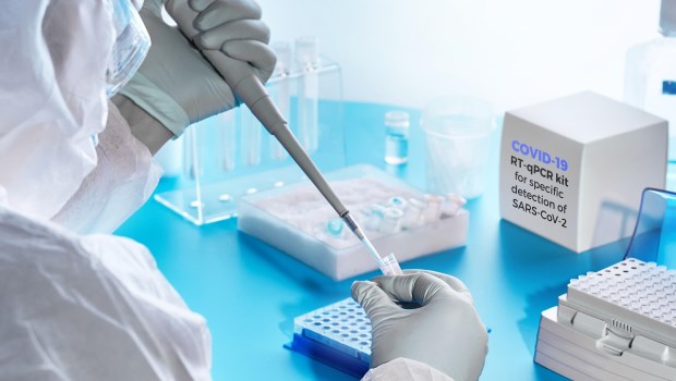  Técnica de diagnóstico PCR: qué significa un resultado positivo