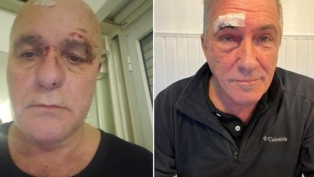 Arnaldo Bresciani y Guillermo Parise fueron agredidos el 20 de junio pasado en Vicente López.