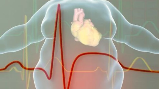 La obesidad dificulta el diagnóstico y el tratamiento de la enfermedad cardíaca 