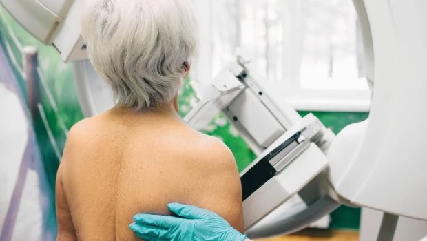 Confirman un alto índice de sobrediagnóstico de cáncer de mama entre mujeres mayores