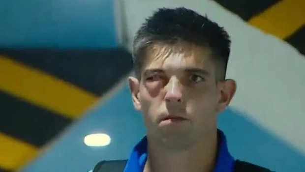 El arquero de San Lorenzo sufrió una fractura en su rostro y estará varios meses inactivo