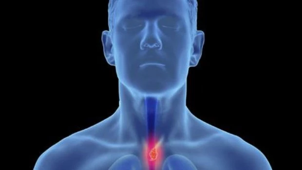 Cáncer de esófago: la respuesta a tres preguntas clave
