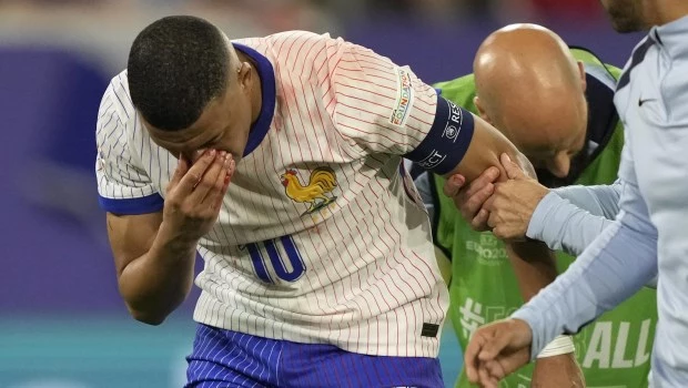 Mbappé se fracturó el tabique nasal y asusta a Francia
