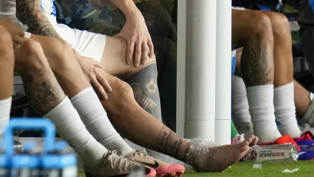 Messi sufrió una lesión ligamentaria en su tobillo derecho