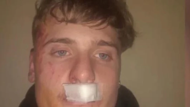 Un joven recibió una brutal golpiza por parte de rugbiers en Zárate: “Pudo ser como Fernando Báez Sosa”