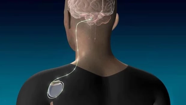 Enfoques quirúrgicos para restaurar la función después de un ACV