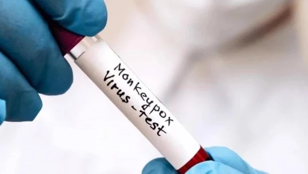 Se confirmó primer caso autóctono de viruela del mono en el país