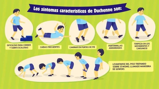 Distrofia muscular de Duchenne: cuáles son los signos de alerta