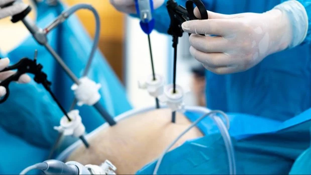 Cirugía de la obesidad: persisten los obstáculos para acceder al tratamiento