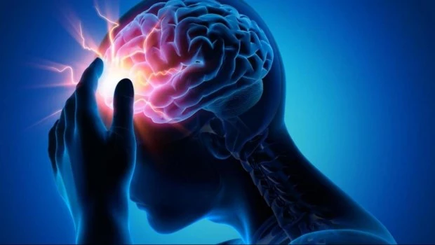 ACV: La importancia del tiempo para reducir secuelas y mortalidad