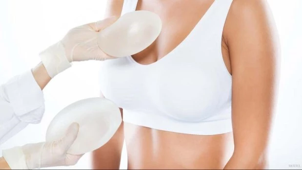 Mitos y verdades sobre las prótesis mamarias: una guía completa