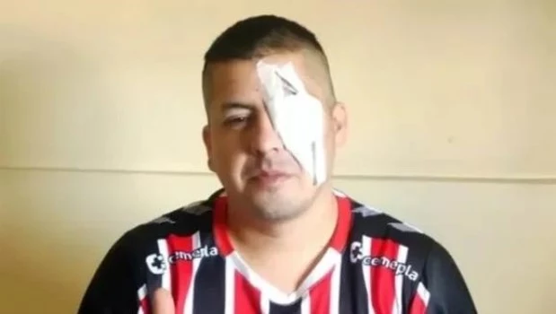Un hincha de Chacarita denunció a Patricia Bullrich tras perder un ojo por la represión en el Congreso