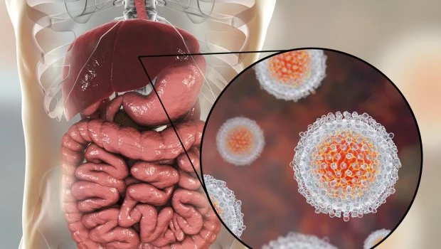 Hepatitis C virus infection medical concept�