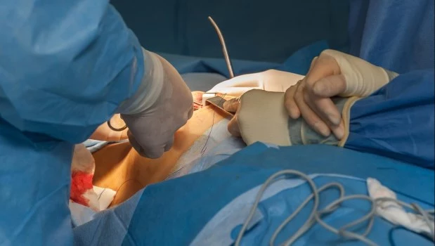 Lifting y reducción: la cirugía mamaria que escala en la medicina estética moderna 