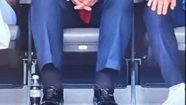 Trump fue diagnosticado con insuficiencia venosa crónica