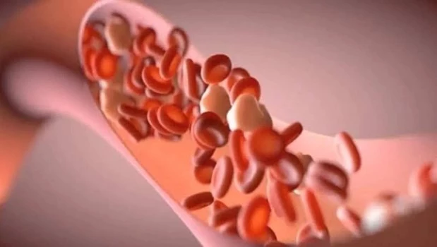 La edad de las arterias permite predecir el riesgo cardiovascular