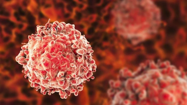 Día de la Leucemia Linfocítica Crónica: ¿Qué es?