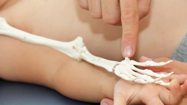 Acondroplasia: ya está disponible en Argentina la primera medicación para el tratamiento