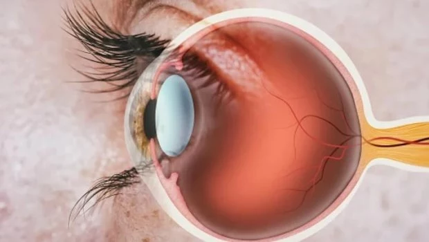El valor del tratamiento temprano en las afecciones de la visión