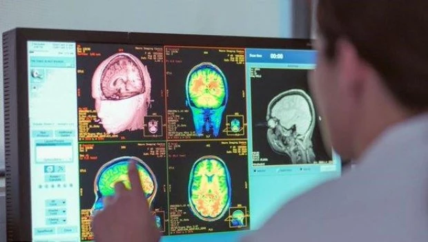 Un estudio asegura que la adolescencia dura hasta los 32 años