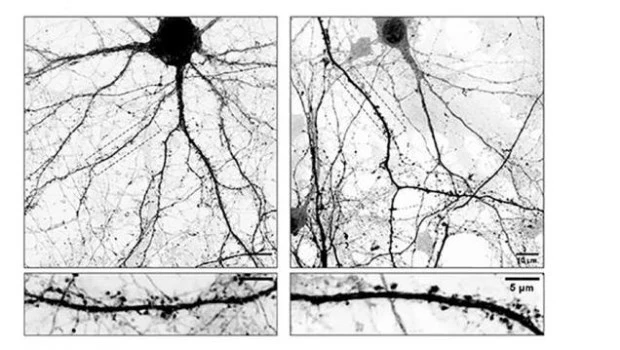 Develan mecanismos que podrían optimizar las terapias contra el Parkinson