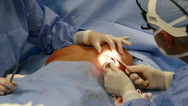 Cirugía mamaria: 10 claves esenciales antes de pasar por el quirófano