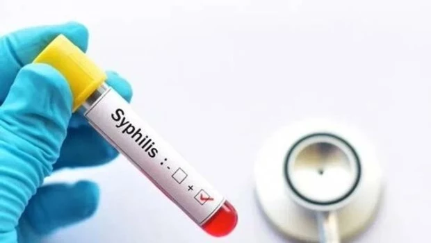 En la Argentina se registraron más de 50 mil casos de sífilis