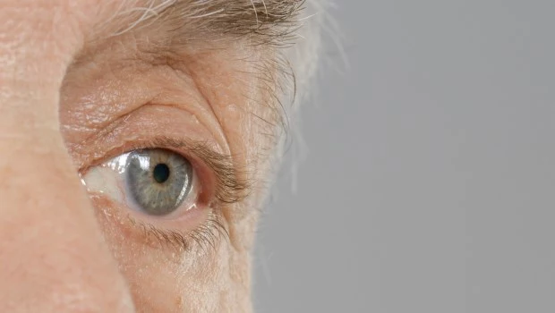 Glaucoma en el mundo: una preocupación creciente