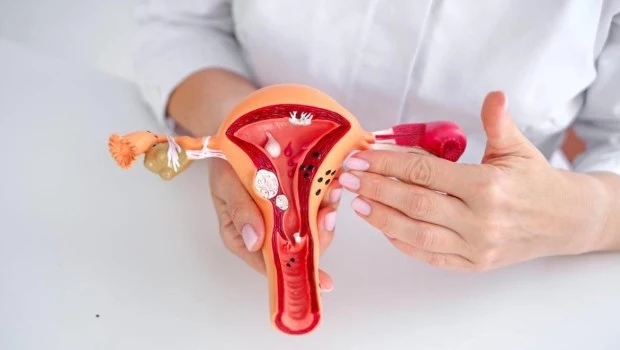 Endometriosis: entre el 50% y 70% de las mujeres logran un embarazo espontáneo