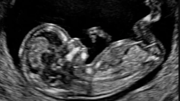 Hay una vida que no tiene voz, pero sí valor