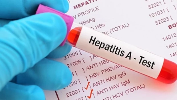 Alerta por un aumento de los casos de hepatitis A