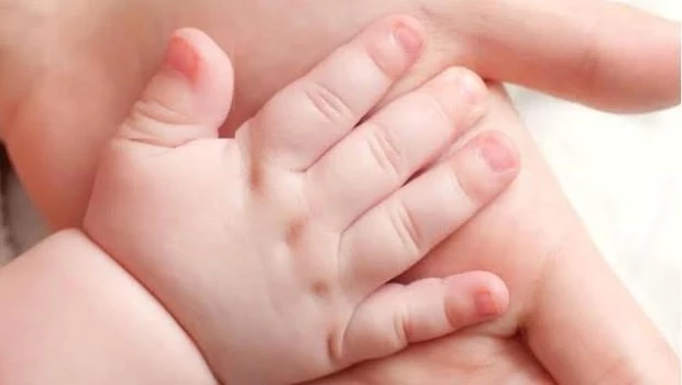 Síndrome de Rubinstein-Taybi: el diagnóstico precoz mejora la calidad de vida