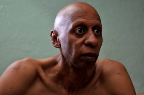El cubano disidente Guillermo Fariñas levantó el ayuno