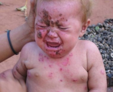 No hay control sobre los pesticidas