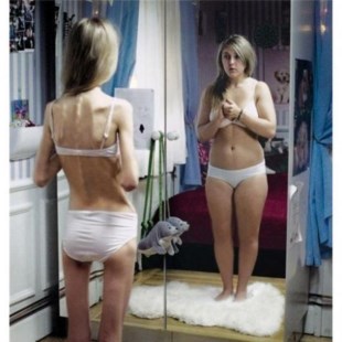 Consejos prácticos para ayudar a una persona con anorexia 