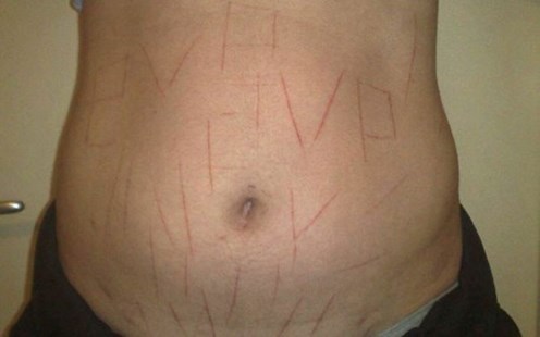 Sería mentira el ataque neonazi a una brasileña