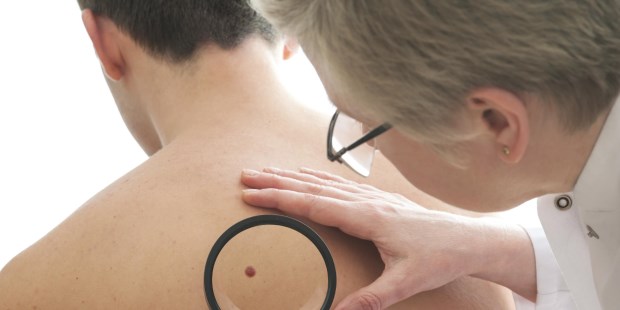 El melanoma mata a más de 10 argentinos por semana