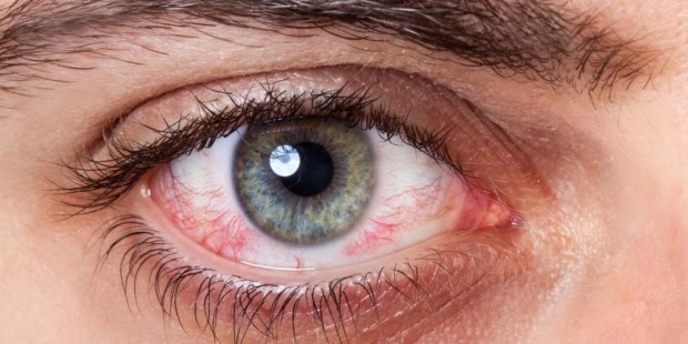 El síndrome de ojo seco se puede prevenir mediante la alimentación