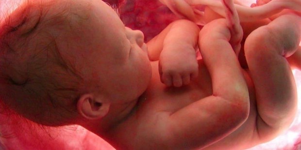 Lo que prefieren callar acerca del aborto 