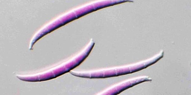Soja: Controlan una grave enfermedad